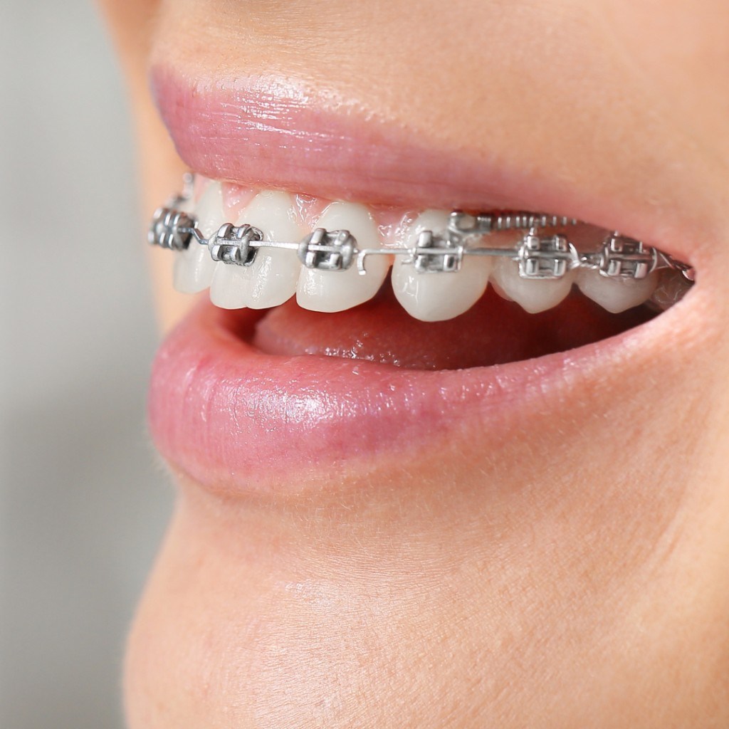 Orthodontics