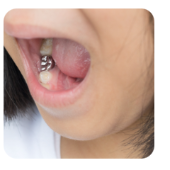 Restorative Dentistry